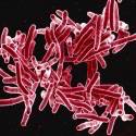 Aumento de casos graves de tuberculose preocupa, diz estudo